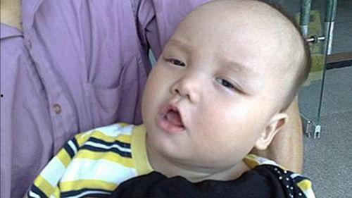 舌头痛吃瓜视频